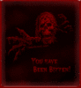 You have been bitten