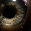 eye ball