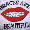 braces