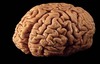 A BRAIN!!
