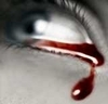 Tears of blood