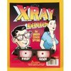 x-ray viewer