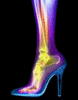 X-Ray Stilletos