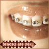 braces