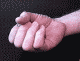 the hand